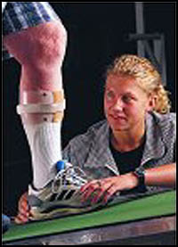 Physical Therapy and Orthotics for Knee Osteoarthritis
