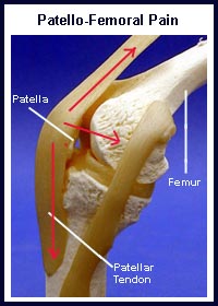 The Patellofemoral Joint