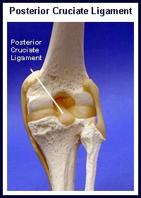 Posterior Cruciate Ligament Injuries | Knee Pain Info