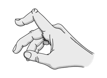 Bouteniere Deformity of the Hand