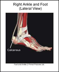 Calcaneus of right foot