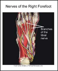 Nerves of the Forefoot